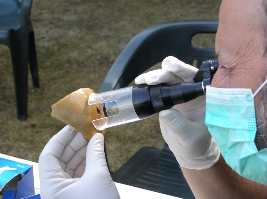 Examen con un microscopio de campo de una herida de flecha en uno de los restos craneales.