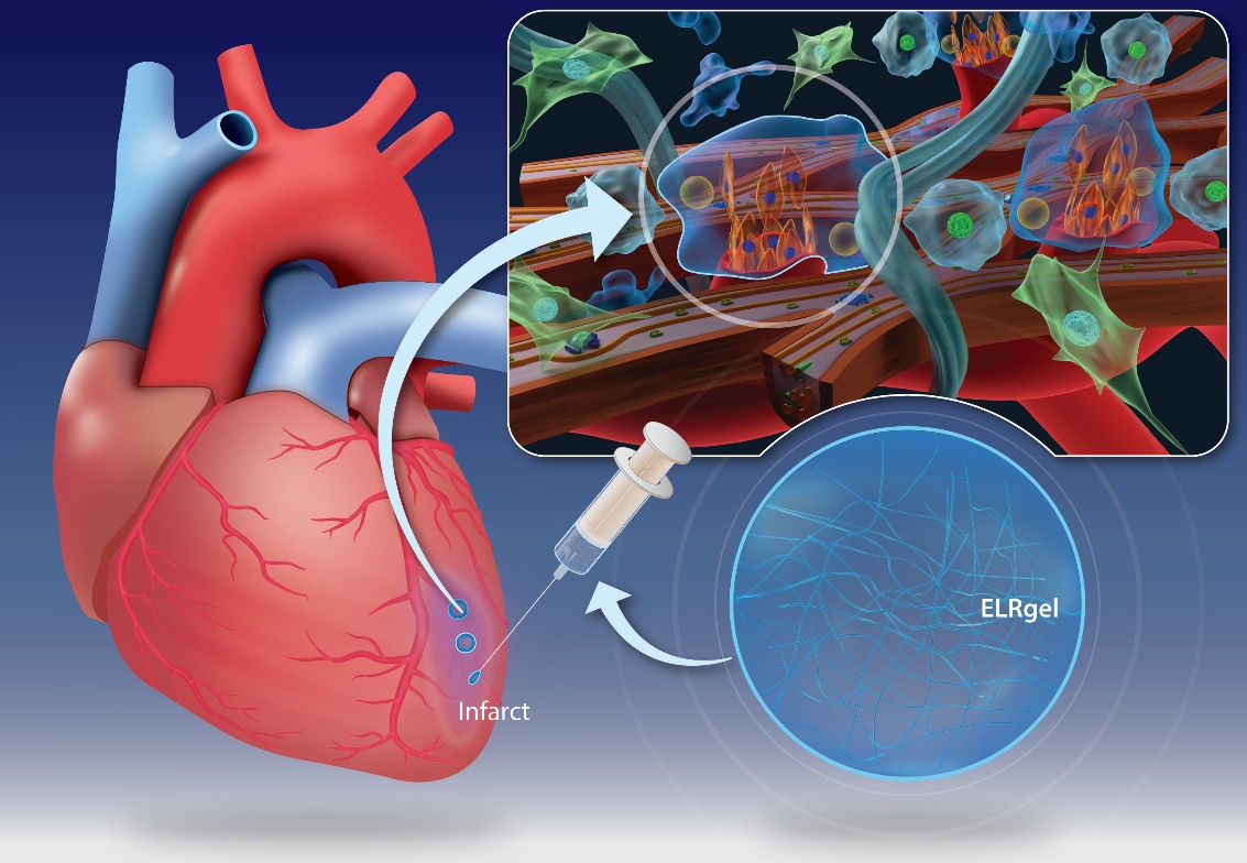 La inyección de un hidrogel diseñado por investigadores de la UVa puede promover la curación del músculo cardíaco después de un infarto de miocardio