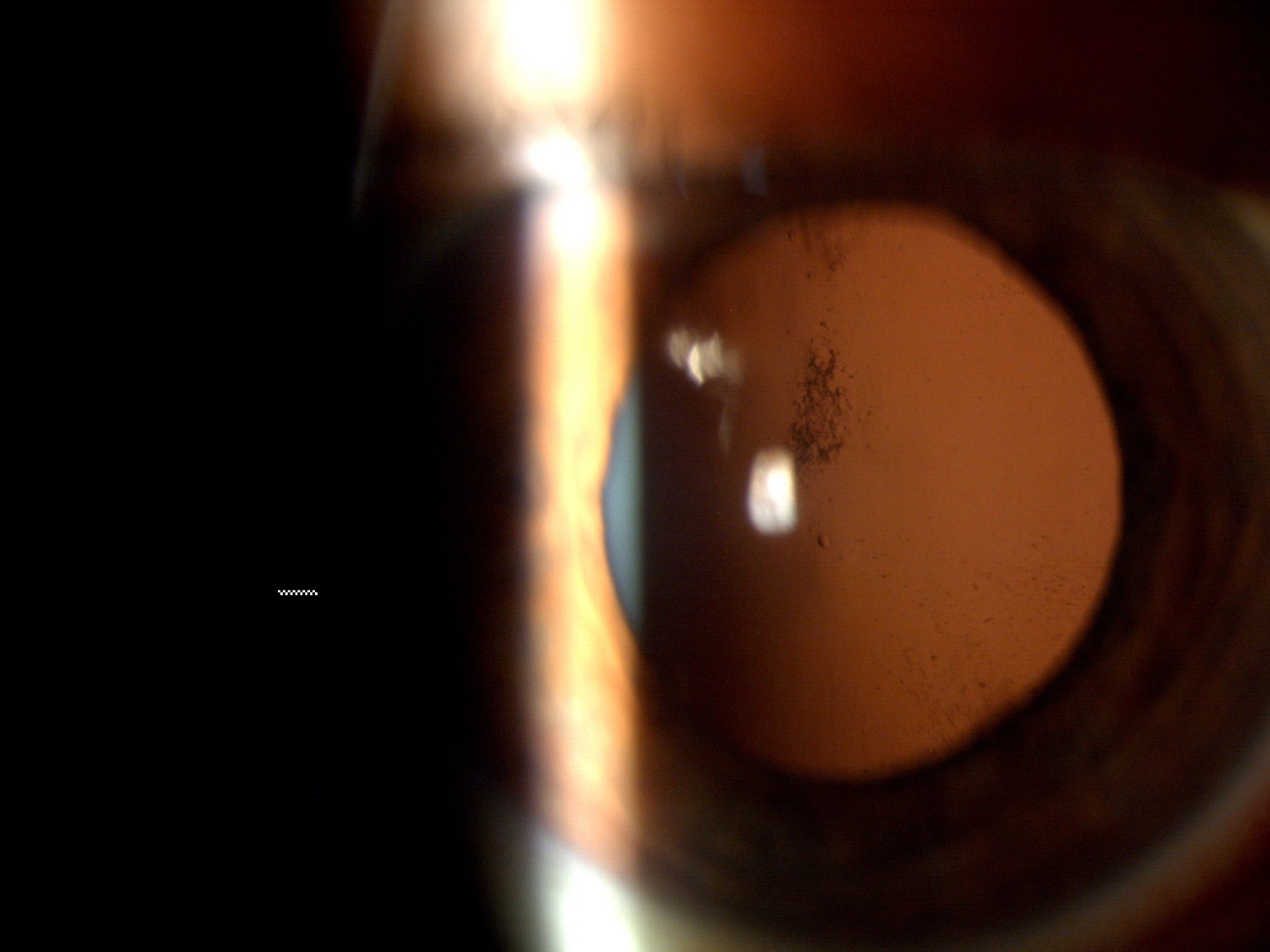 Primeras fotografías de las células madre en el interior del ojo de un paciente
