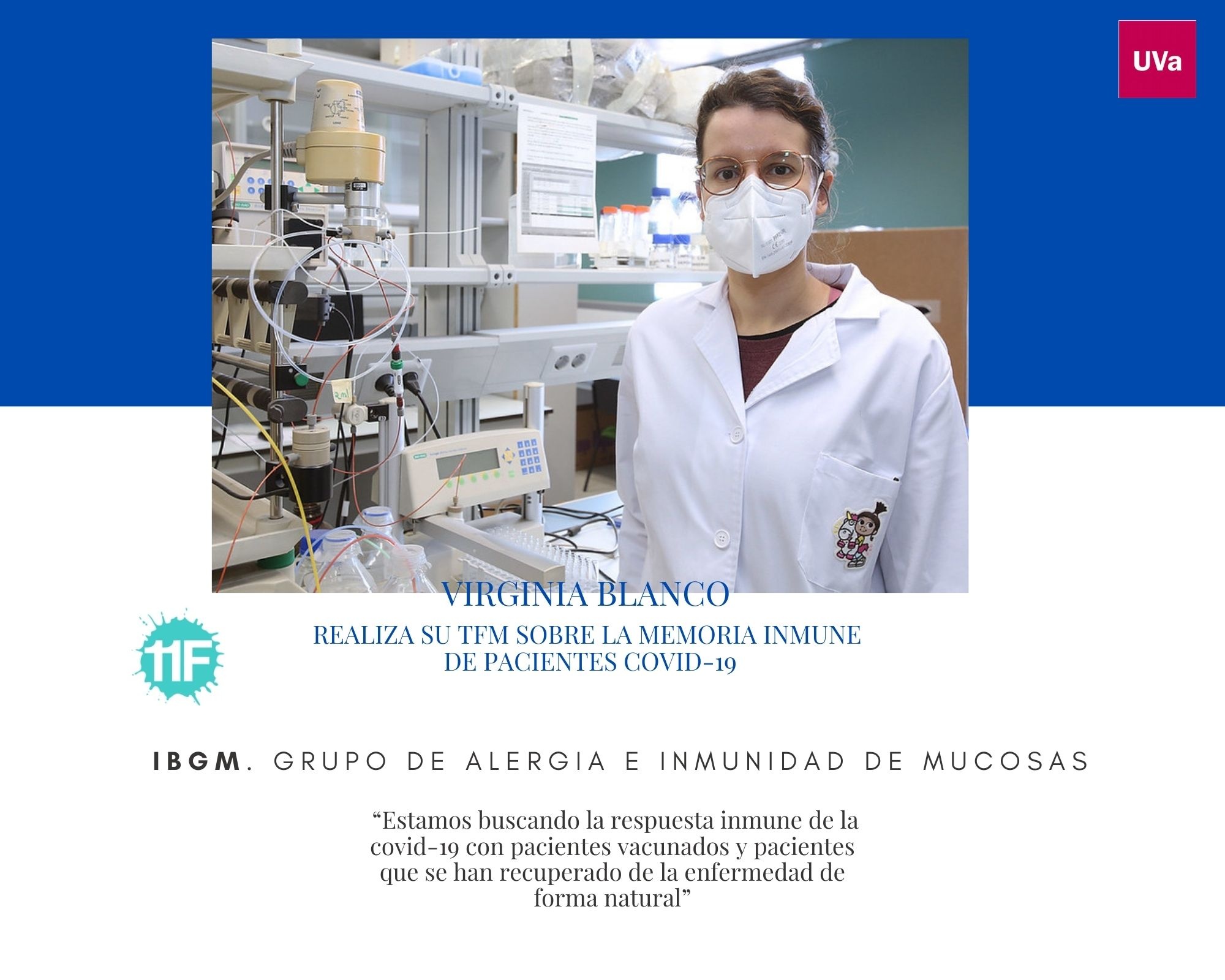 IBGM