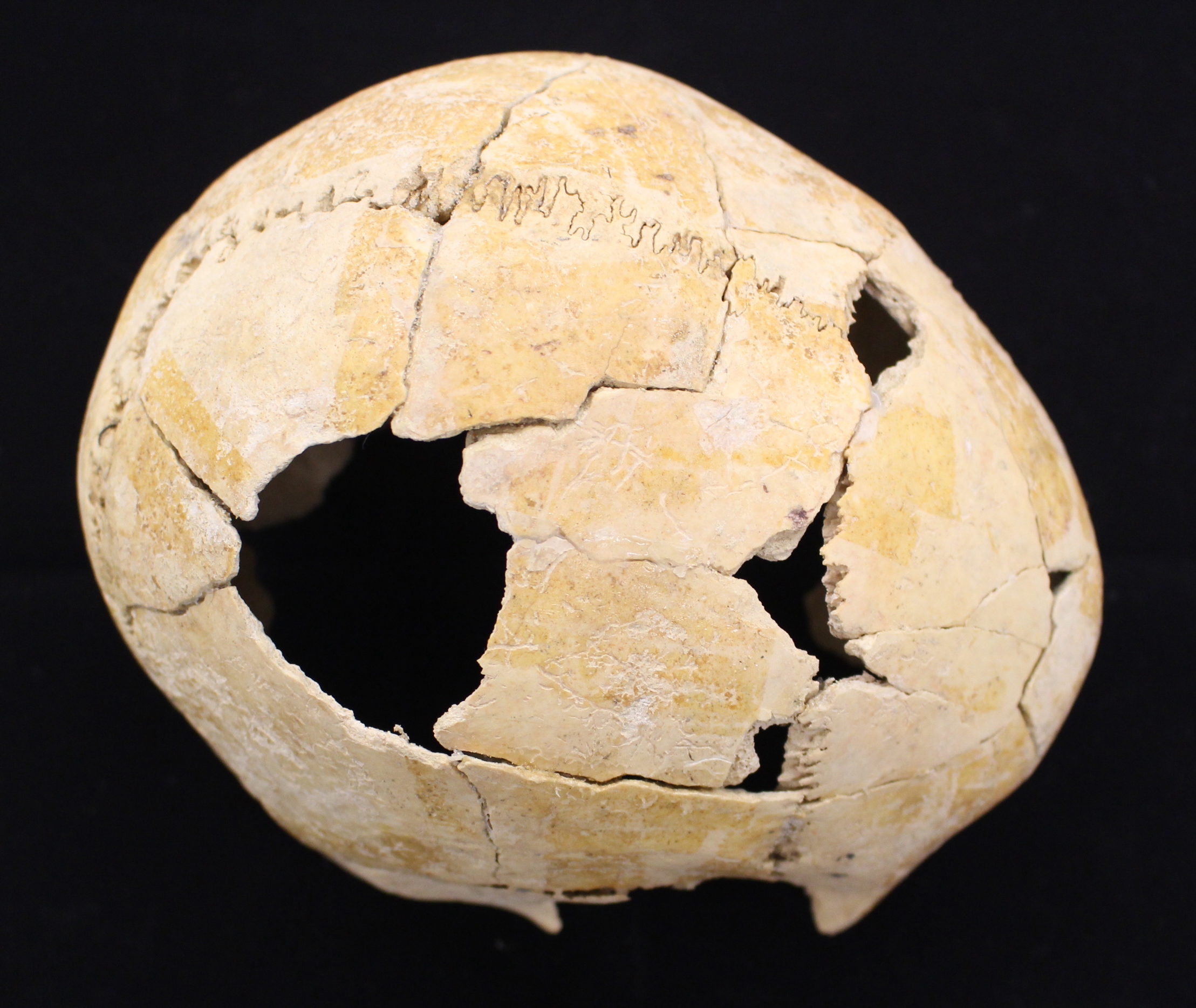 Cráneo con impacto. Autora Teresa Fernández Crespo