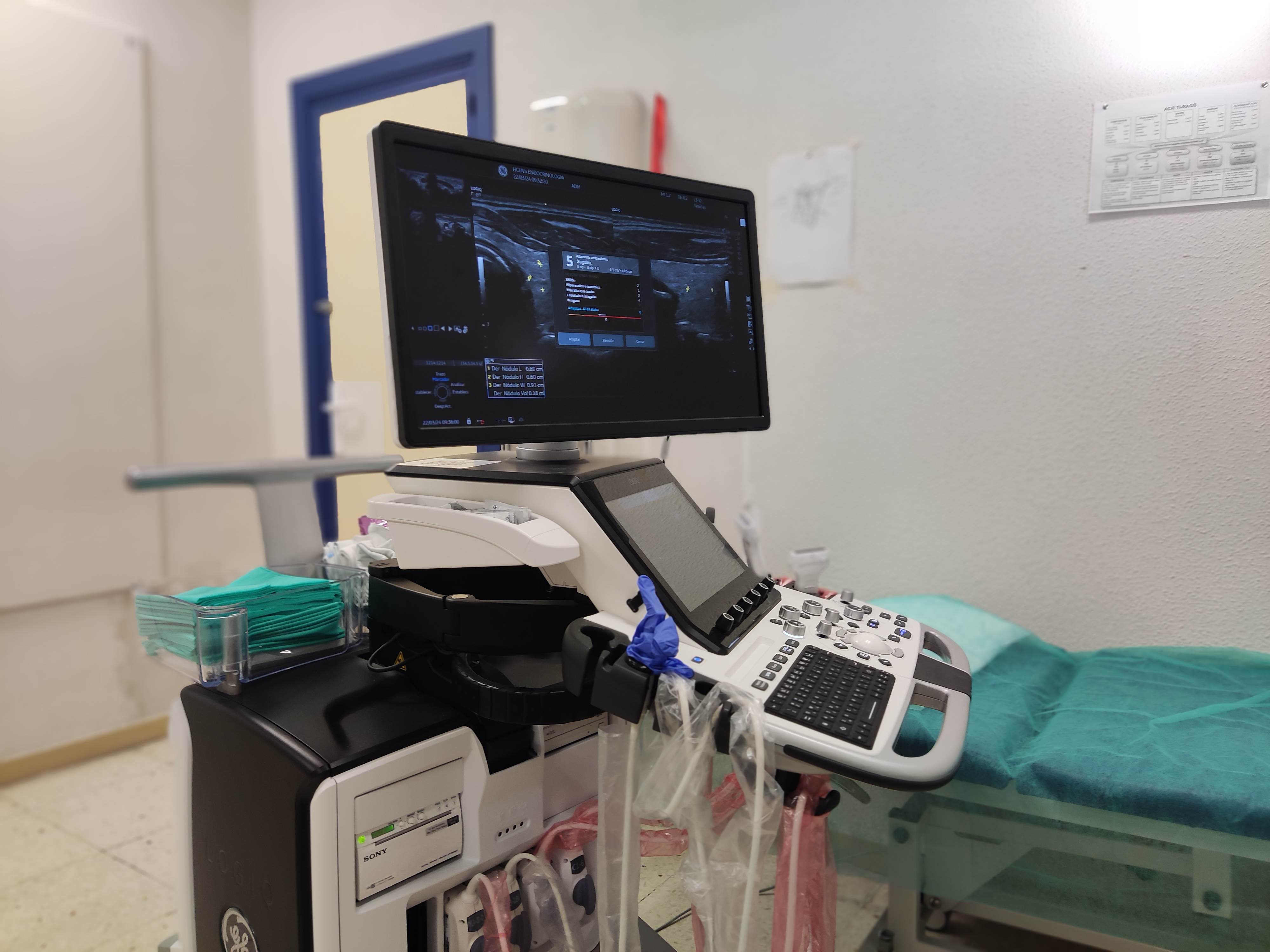 El Hospital Clínico Universitario de Valladolid ha adquirido un nuevo ecógrafo con licencia de uso del nuevo software