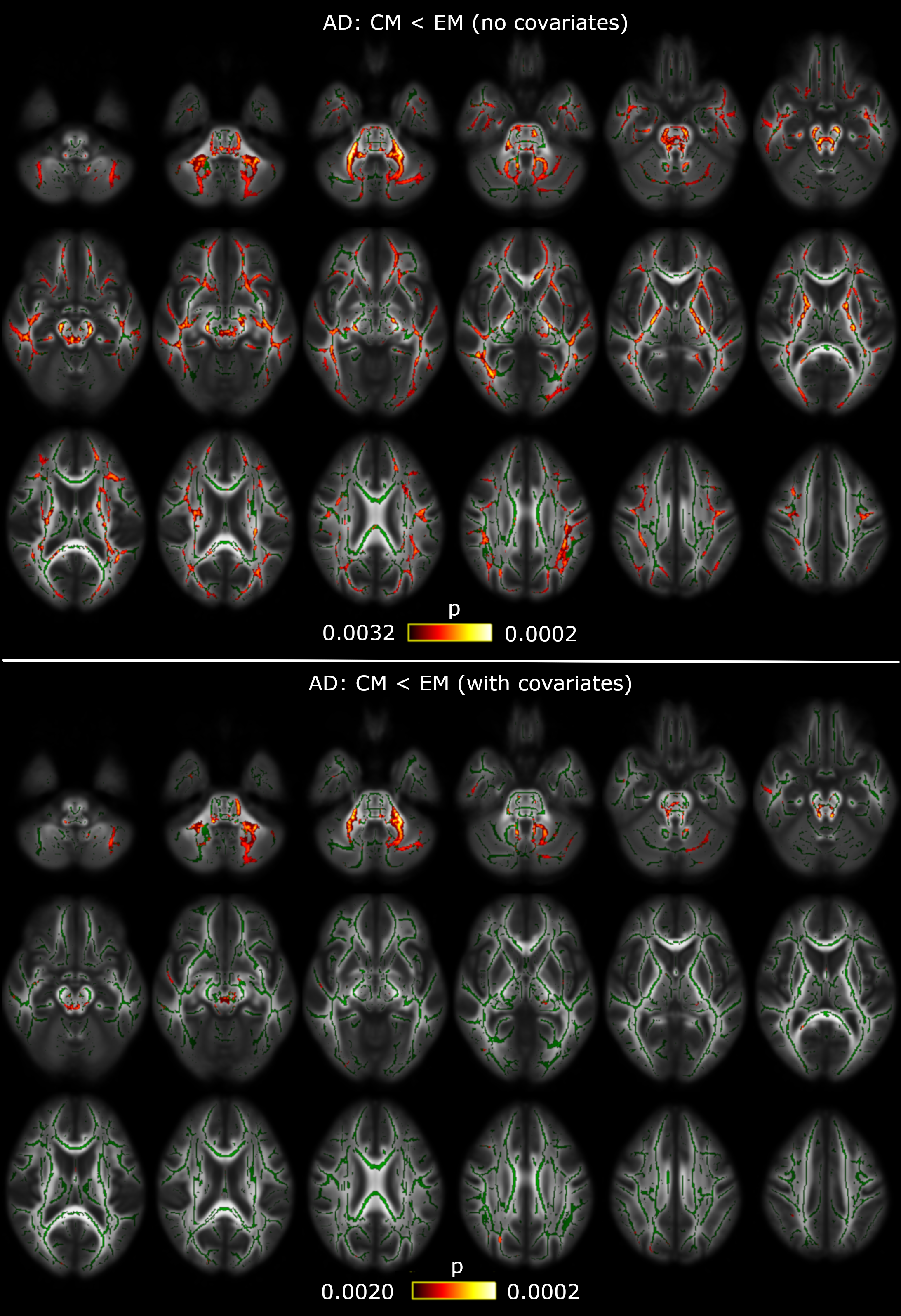 Diferencias significativas entre pacientes con migraña crónica y episódica./A. Planchuelo.