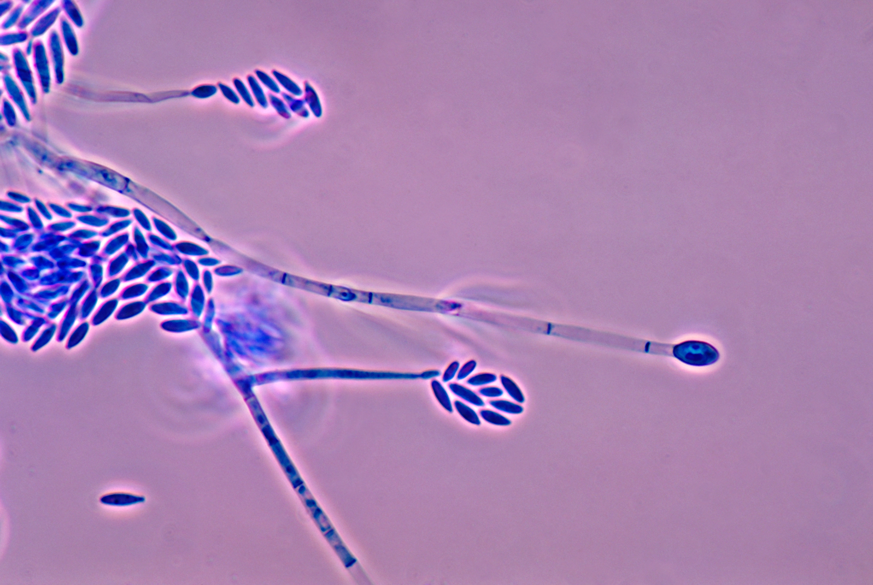 Hongo del género Fusarium, uno de los patógenos de plantas que se investigará en el Proyecto SUPERA